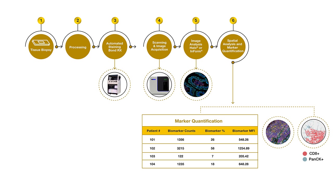 Les flux de travail personnalisés de Precision for Medicine génèrent des informations complexes à partir d'un SI multiplex.